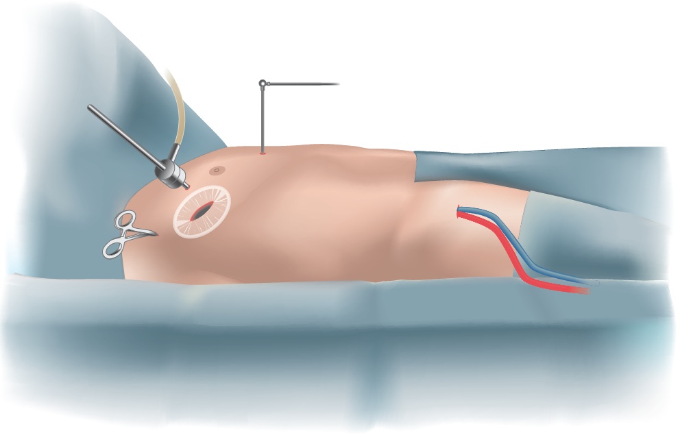 Surgical Setup